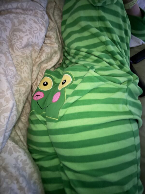 Frog Smile Flap-Butt PJ’s